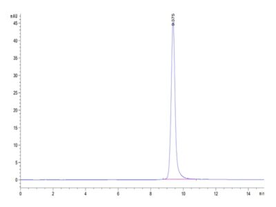 Human Annexin V/ANXA5 Protein , AN5-HE005 Ushelf