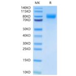 Human BCHEButyrylcholinesterase-Protein , BCE-HM101