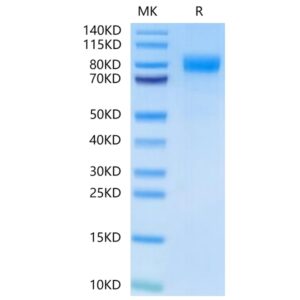 Human BCHE/Butyrylcholinesterase-Protein , BCE-HM101 Ushelf
