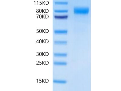 Human BCHE/Butyrylcholinesterase-Protein , BCE-HM101 Ushelf