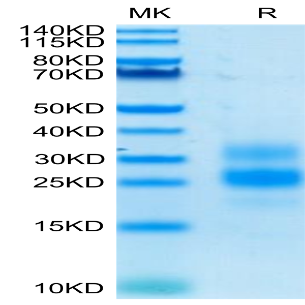 Human ICOS/CD278 Protein (ICO-HM101)