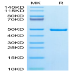 Human IDH1 Protein (IDH-HE101)