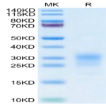 Cynomolgus IFN gamma/IFNG Protein (IFN-CM10G)