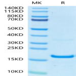 Human IFN gamma/IFNG Protein (IFN-HM00G)