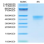 Human IFN alpha/beta R2 Protein (IFN-HM10R)