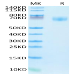 Human IFN gamma R1/IFNGR1 Protein (IFN-HM2GR)