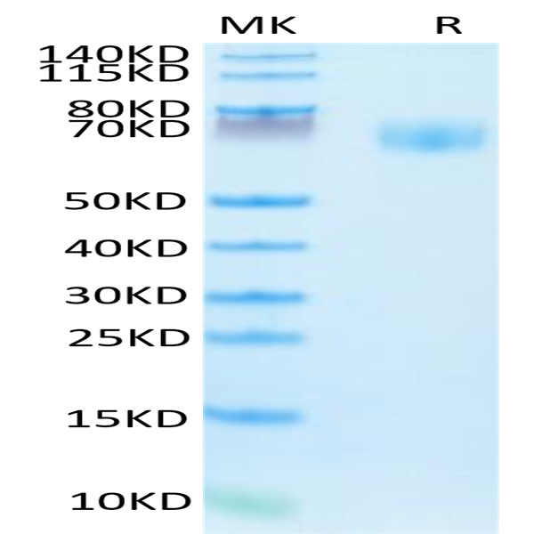 Human IFN gamma R1/IFNGR1 Protein (IFN-HM2GR)