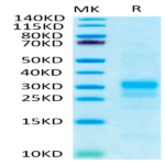 Human IFN gamma/IFNG Protein (IFN-HM40G)