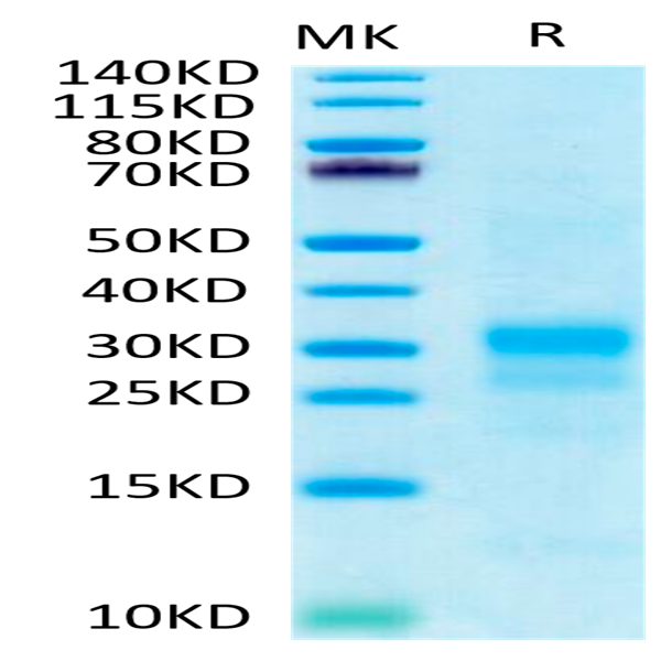 Human IFN gamma/IFNG Protein (IFN-HM40G)