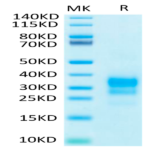 Biotinylated Human IFN gamma/IFNG Protein (IFN-HM40GB)