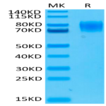 Human IFN alpha/beta R1 Protein (IFN-HM4R1)