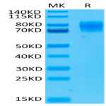 Biotinylated Human IFN alpha/beta R1 Protein (IFN-HM4R1B)