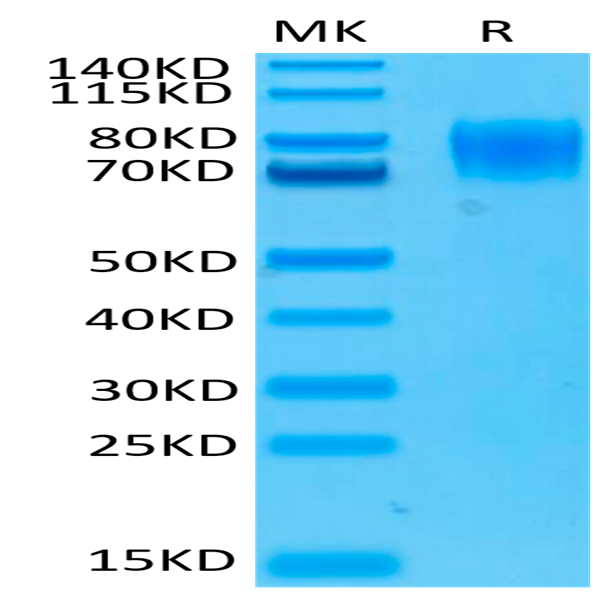 Biotinylated Human IFN alpha/beta R1 Protein (IFN-HM4R1B)