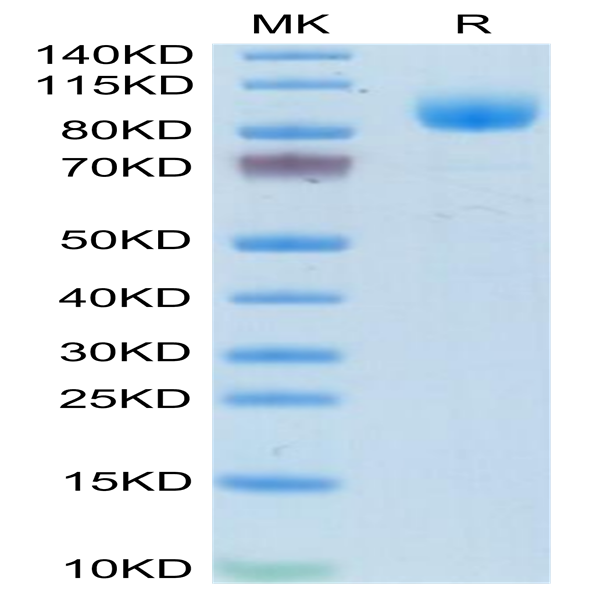 Mouse IFN alpha/beta R1 Protein (IFN-MM2R1)