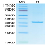 Human IgE Protein (IGE-HM401)