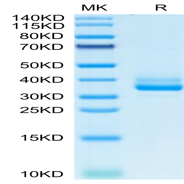 Mouse IgE Protein (IGE-MM401)