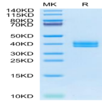 Cynomolgus IGFBP2 Protein (IGF-CM102)