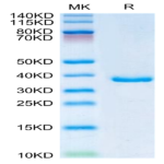 Human IGFBP2 Protein (IGF-HM102)