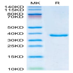Human IGFBP2 Protein (IGF-HM102)