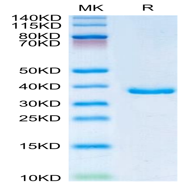 Human IGFBP2 Protein (IGF-HM102)