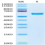 Human IGF2R Domain 1-3 Protein (IGF-HM1RD)