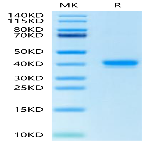 Human IGFI Protein (IGF-HM201)