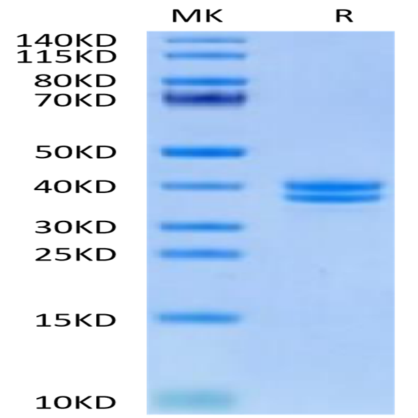 Human IGFII Protein (IGF-HM202)