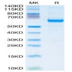 Human IGFBP-3R Protein (IGF-HM23R)
