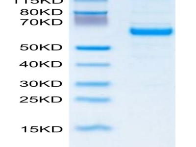 Human IGFBP-3R Protein (IGF-HM23R)