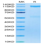 Human IGF1R/CD221 Protein (IGF-HM41R)