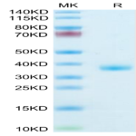 Mouse IGFBP2 Protein (IGF-MM102)