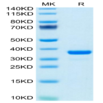 Mouse IGFBP-7 Protein (IGF-MM1BP)