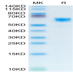 Mouse IGFBP-3R Protein (IGF-MM23R)