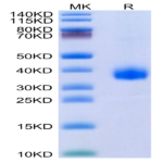 SARS-Cov-2 Spike RBD (B.1.640.2/IHU) Protein (IHU-VM1RD)