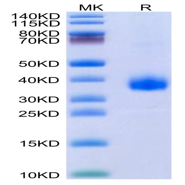SARS-Cov-2 Spike RBD (B.1.640.2/IHU) Protein (IHU-VM1RD)