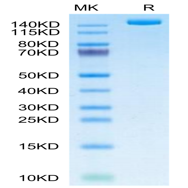 SARS-COV-2 Spike S (B.1.640.2/IHU) Trimer Protein (IHU-VM1ST)