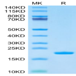 Cynomolgus IL-1 Beta/IL-1F2 Protein (IL1-CE10B)