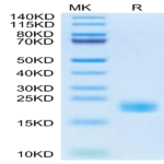 Cynomolgus IL-11 Protein (IL1-CM111)