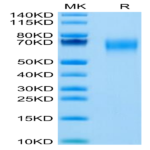 Cynomolgus IL-1 Rrp2/IL-1 R6 Protein (IL1-CM1L2)