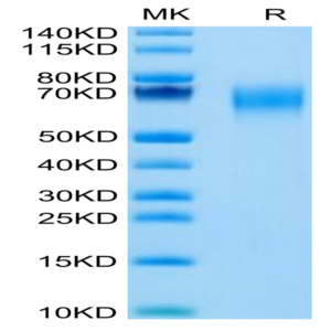 Cynomolgus IL-1 Rrp2/IL-1 R6 Protein (IL1-CM1L2)