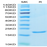 Human IL-1 alpha/IL-1A Protein (IL1-HE00A)