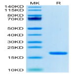 Biotinylated Human IL-18 Protein (Primary Amine Labeling) (IL1-HE018B)