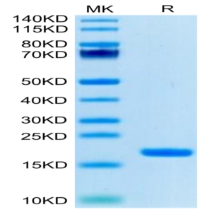 Biotinylated Human IL-18 Protein (Primary Amine Labeling) (IL1-HE018B)