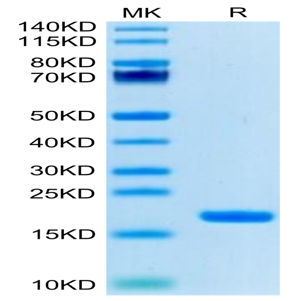 Biotinylated Human IL-18 Protein (Primary Amine Labeling) (IL1-HE018B)
