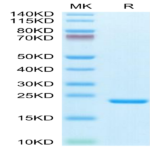 Biotinylated Human IL-1 Beta/IL-1F2 Protein (IL1-HE40BB)