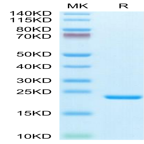 Biotinylated Human IL-1 Beta/IL-1F2 Protein (IL1-HE40BB)