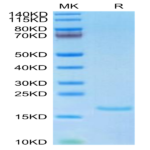 Human IL-10 Protein (IL1-HM010)