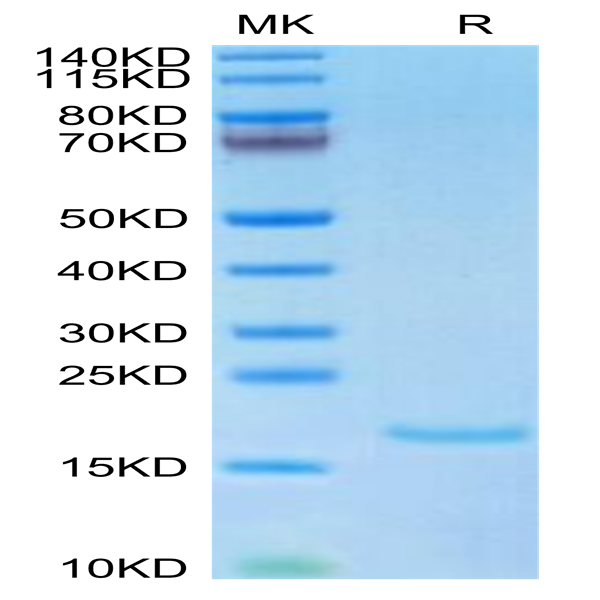 Human IL-10 Protein (IL1-HM010)