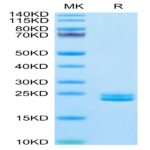 Human IL-11 Protein (IL1-HM111)