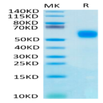 Human IL-1R2/IL-1 RII/CD121b Protein (IL1-HM1R2)